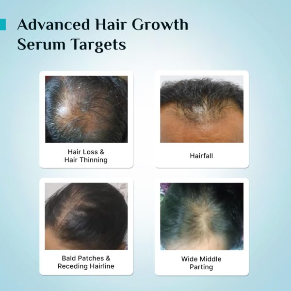 PILGRIM Redensyl 3%+Anagain 4% Advanced Hair Growth Serum - Image 2