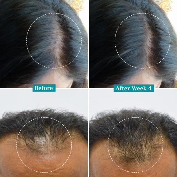 PILGRIM Redensyl 3%+Anagain 4% Advanced Hair Growth Serum - Image 7